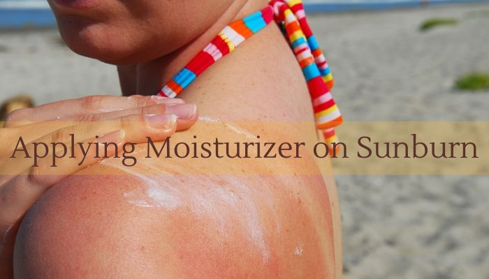 Moisturizer on Sunburn