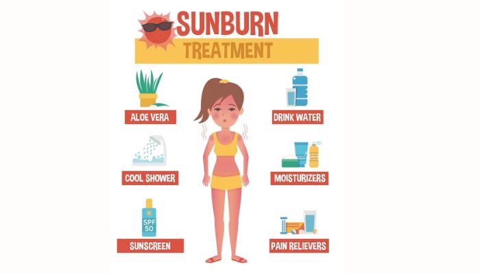 sunburn remedies (moisturizer)